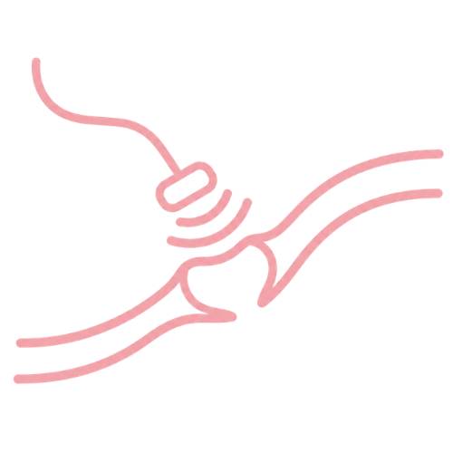 neuromodulación